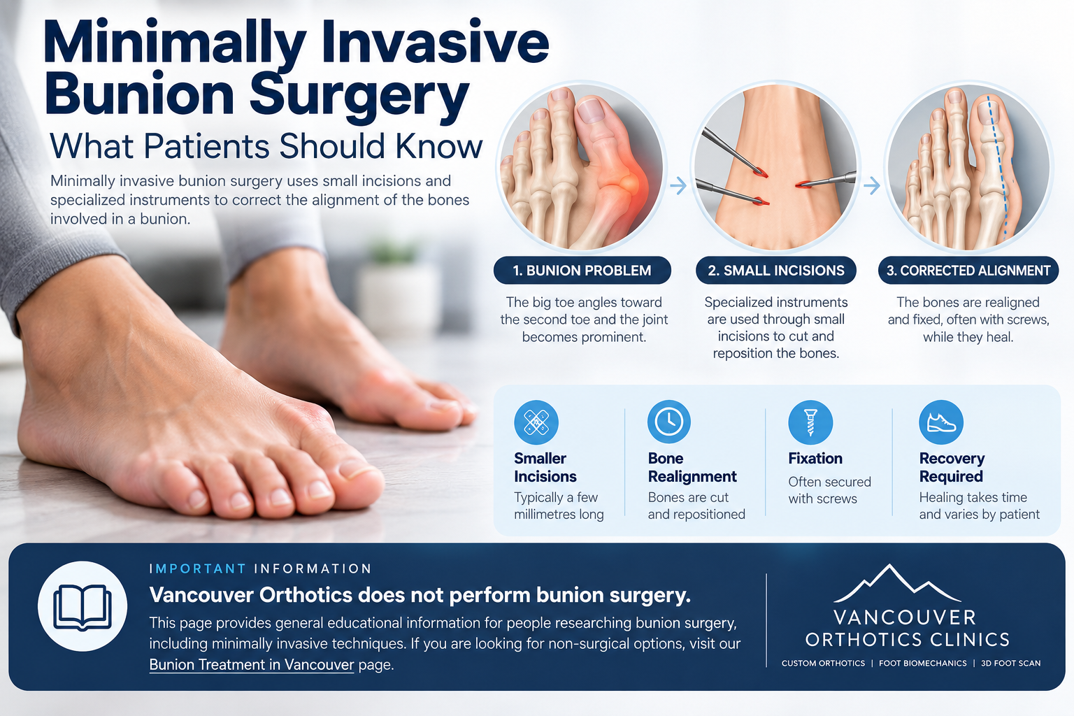 Minimally Invasive Bunion Surgery Vancouver and Canada Minimally invasive bunion surgery information for patients in Vancouver and Canada